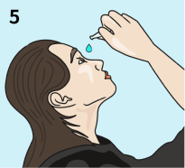 圖片:正確滴注眼藥水(切記，避免藥瓶開口處，碰到眼球或任何其他地方，而造成汙染)